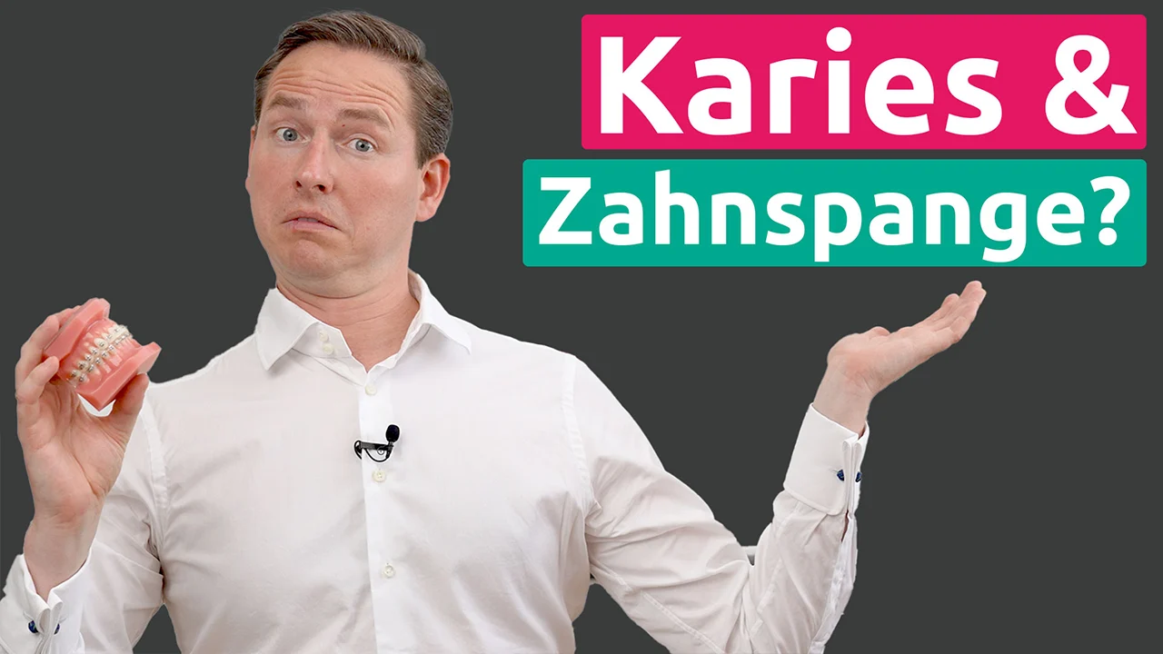 Karies Zahnspange