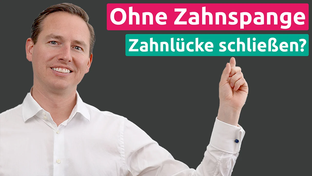 Zahnlücke schließen ohne Zahnspange