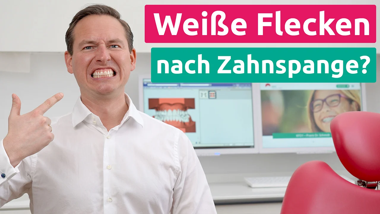 Weiße Flecken nach Zahnspange